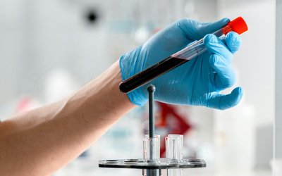 BS Medical Laboratory Technology